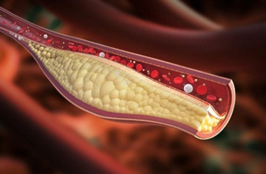Cholesterol 